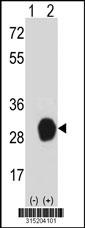 Western blot analysis of his-tag ARL11 (arrow) using his tag antibody. 293 cell lysates (2 ug/lane) either nontransfected (Lane 2) or transiently transfected with theARL11 gene