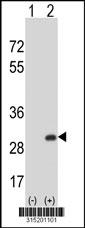 Western blot analysis of his-tag RAB14 (arrow) using his tag antibody. 293 cell lysates (2 ug/lane) either nontransfected (Lane 2) or transiently transfected with theRAB14 gene