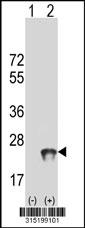 Western blot analysis of his-tag C6orf64 (arrow) using his tag antibody. 293 cell lysates (2 ug/lane) either nontransfected (Lane 2) or transiently transfected with theC6orf64 gene