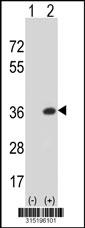 Western blot analysis of his-tag CIP29 (arrow) using his tag antibody. 293 cell lysates (2 ug/lane) either nontransfected (Lane 2) or transiently transfected with theCIP29 gene