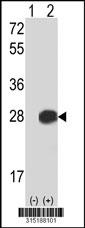 Western blot analysis of his-tag COPZ1 (arrow) using his tag antibody. 293 cell lysates (2 ug/lane) either nontransfected (Lane 2) or transiently transfected with theCOPZ1 gene