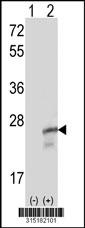 Western blot analysis of his-tag RGS13 (arrow) using his tag antibody. 293 cell lysates (2 ug/lane) either nontransfected (Lane 2) or transiently transfected with theRGS13 gene