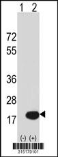 Western blot analysis of his-tag RPL36 (arrow) using his tag antibody. 293 cell lysates (2 ug/lane) either nontransfected (Lane 2) or transiently transfected with theRPL36 gene