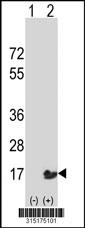 Western blot analysis of his-tag DNAL4 (arrow) using his tag antibody. 293 cell lysates (2 ug/lane) either nontransfected (Lane 2) or transiently transfected with theDNAL4 gene