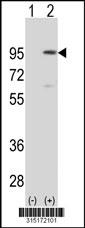 Western blot analysis of his-tag EZH2 (arrow) using his tag antibody. 293 cell lysates (2 ug/lane) either nontransfected (Lane 2) or transiently transfected with theEZH2 gene