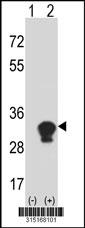 Western blot analysis of his-tag PGRMC1 (arrow) using his tag antibody. 293 cell lysates (2 ug/lane) either nontransfected (Lane 2) or transiently transfected with thePGRMC1 gene