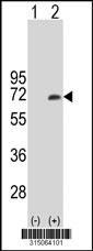 Western blot analysis of his-tag RHOT2 (arrow) using his tag antibody. 293 cell lysates (2 ug/lane) either nontransfected (Lane 2) or transiently transfected with theRHOT2 gene