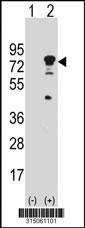 Western blot analysis of his-tag C19orf44 (arrow) using his tag antibody. 293 cell lysates (2 ug/lane) either nontransfected (Lane 2) or transiently transfected with theC19orf44 gene