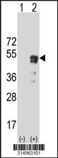 Western blot analysis of his-tag SGCA (arrow) using his tag antibody. 293 cell lysates (2 ug/lane) either nontransfected (Lane 2) or transiently transfected with theSGCA gene