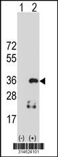 Western blot analysis of his-tag LRRC59 (arrow) using his tag antibody. 293 cell lysates (2 ug/lane) either nontransfected (Lane 2) or transiently transfected with theLRRC59 gene