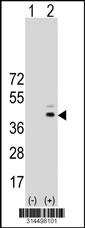 Western blot analysis of his-tag SPIB (arrow) using his tag antibody. 293 cell lysates (2 ug/lane) either nontransfected (Lane 2) or transiently transfected with theSPIB gene