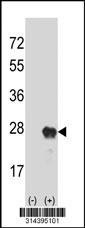 Western blot analysis of his-tag LHFPL5 (arrow) using his tag antibody. 293 cell lysates (2 ug/lane) either nontransfected (Lane 2) or transiently transfected with theLHFPL5 gene