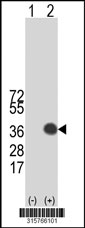 Western blot analysis of his-tag CCDC107 (arrow) using his tag antibody. 293T cell lysates (2 ug/lane) either nontransfected (Lane 1) or transiently transfected with the CCDC107 gene‘