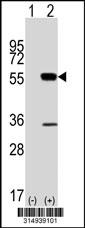Western blot analysis of his-tag SMARCD1 (arrow) using his tag antibody. 293 cell lysates (2 ug/lane) either nontransfected (Lane 1) or transiently transfected with the SMARCD1 gene.