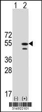 Western blot analysis of his-tag PSMD5 (arrow) using his tag antibody. 293 cell lysates (2 ug/lane) either nontransfected (Lane 1) or transiently transfected with the PSMD5 gene.