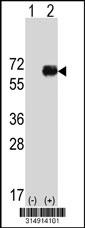 Western blot analysis of his-tag SP100 (arrow) using his tag antibody. 293 cell lysates (2 ug/lane) either nontransfected (Lane 1) or transiently transfected with the SP100 gene.