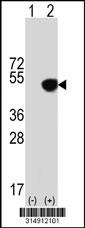 Western blot analysis of his-tag FUT9 (arrow) using his tag antibody. 293 cell lysates (2 ug/lane) either nontransfected (Lane 1) or transiently transfected with the FUT9 gene.