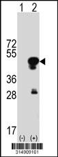 Western blot analysis of his-tag TMOD1 (arrow) using his tag antibody. 293 cell lysates (2 ug/lane) either nontransfected (Lane 1) or transiently transfected with the TMOD1 gene.