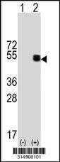 Western blot analysis of his-tag CHST10 (arrow) using his tag antibody. 293 cell lysates (2 ug/lane) either nontransfected (Lane 1) or transiently transfected with the CHST10 gene.
