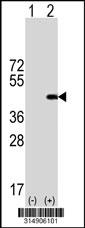 Western blot analysis of his-tag C3orf37 (arrow) using his tag antibody. 293 cell lysates (2 ug/lane) either nontransfected (Lane 1) or transiently transfected with the C3orf37 gene.