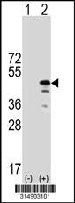 Western blot analysis of his-tag C19orf47 (arrow) using his tag antibody. 293 cell lysates (2 ug/lane) either nontransfected (Lane 1) or transiently transfected with the C19orf47 gene.