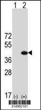 Western blot analysis of his-tag DYNC2LI1 (arrow) using his tag antibody. 293 cell lysates (2 ug/lane) either nontransfected (Lane 1) or transiently transfected with the DYNC2LI1 gene.