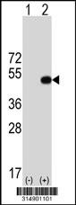 Western blot analysis of his-tag KERA (arrow) using his tag antibody. 293 cell lysates (2 ug/lane) either nontransfected (Lane 1) or transiently transfected with the KERA gene.