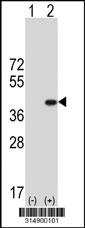 Western blot analysis of his-tag DND1 (arrow) using his tag antibody. 293 cell lysates (2 ug/lane) either nontransfected (Lane 1) or transiently transfected with the DND1 gene.