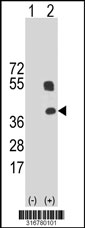 Western blot analysis of his-tag CREBZF (arrow) using his tag antibody. 293T cell lysates (2 ug/lane) either nontransfected (Lane 1) or transiently transfected with the CREBZF gene‘