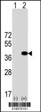 Western blot analysis of his-tag HEYL (arrow) using his tag antibody. 293 cell lysates (2 ug/lane) either nontransfected (Lane 1) or transiently transfected with the HEYL gene.