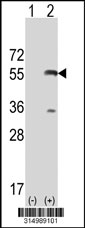 Western blot analysis of his-tag SYAP1 (arrow) using his tag antibody. 293T cell lysates (2 ug/lane) either nontransfected (Lane 1) or transiently transfected with the SYAP1 gene‘