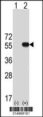 Western blot analysis of his-tag TUBA1A (arrow) using his tag antibody. 293 cell lysates (2 ug/lane) either nontransfected (Lane 1) or transiently transfected with the TUBA1A gene.