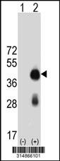 Western blot analysis of his-tag SFTPB (arrow) using his tag antibody. 293 cell lysates (2 ug/lane) either nontransfected (Lane 1) or transiently transfected with the SFTPB gene.