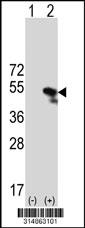 Western blot analysis of his-tag B3GNT5 (arrow) using his tag antibody. 293 cell lysates (2 ug/lane) either nontransfected (Lane 1) or transiently transfected with the B3GNT5 gene.