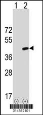 Western blot analysis of his-tag TTL (arrow) using his tag antibody. 293 cell lysates (2 ug/lane) either nontransfected (Lane 1) or transiently transfected with the TTL gene.