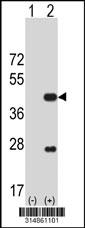 Western blot analysis of his-tag GNA13 (arrow) using his tag antibody. 293 cell lysates (2 ug/lane) either nontransfected (Lane 1) or transiently transfected with the GNA13 gene.