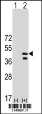 Western blot analysis of his-tag FCHO2 (arrow) using his tag antibody. 293 cell lysates (2 ug/lane) either nontransfected (Lane 1) or transiently transfected with the FCHO2 gene.
