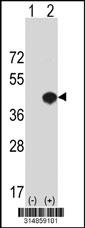 Western blot analysis of his-tag ADAP1 (arrow) using his tag antibody. 293 cell lysates (2 ug/lane) either nontransfected (Lane 1) or transiently transfected with the ADAP1 gene.