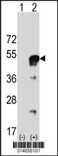 Western blot analysis of his-tag ASAM (arrow) using his tag antibody. 293 cell lysates (2 ug/lane) either nontransfected (Lane 1) or transiently transfected with the ASAM gene.