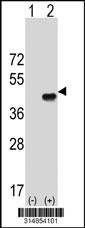 Western blot analysis of his-tag PPM1K (arrow) using his tag antibody. 293 cell lysates (2 ug/lane) either nontransfected (Lane 1) or transiently transfected with the PPM1K gene.