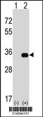 Western blot analysis of his-tag MTHFD1L (arrow) using his tag antibody. 293 cell lysates (2 ug/lane) either nontransfected (Lane 1) or transiently transfected with the MTHFD1L gene.