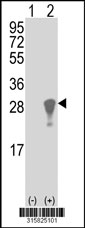 Western blot analysis of his-tag RBP4 (arrow) using his tag antibody. 293T cell lysates (2 ug/lane) either nontransfected (Lane 1) or transiently transfected with the RBP4 gene‘