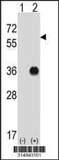 Western blot analysis of his-tag RBM4 (arrow) using his tag antibody. 293 cell lysates (2 ug/lane) either nontransfected (Lane 1) or transiently transfected with the RBM4 gene.