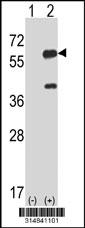 Western blot analysis of his-tag RAD23A (arrow) using his tag antibody. 293 cell lysates (2 ug/lane) either nontransfected (Lane 1) or transiently transfected with the RAD23A gene.