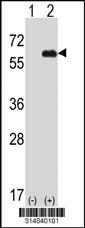Western blot analysis of his-tag VPS72 (arrow) using his tag antibody. 293 cell lysates (2 ug/lane) either nontransfected (Lane 1) or transiently transfected with the VPS72 gene.
