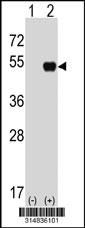 Western blot analysis of his-tag CCNDBP1 (arrow) using his tag antibody. 293 cell lysates (2 ug/lane) either nontransfected (Lane 1) or transiently transfected with the CCNDBP1 gene.