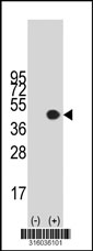 Western blot analysis of his-tag PTGIR (arrow) using his tag antibody. 293T cell lysates (2 ug/lane) either nontransfected (Lane 1) or transiently transfected with the PTGIR gene‘
