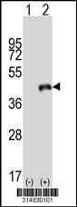 Western blot analysis of his-tag NDRG4 (arrow) using his tag antibody. 293 cell lysates (2 ug/lane) either nontransfected (Lane 1) or transiently transfected with the NDRG4 gene.