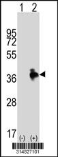 Western blot analysis of his-tag ANXA9 (arrow) using his tag antibody. 293 cell lysates (2 ug/lane) either nontransfected (Lane 1) or transiently transfected with the ANXA9 gene.