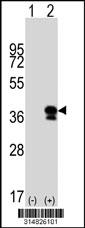 Western blot analysis of his-tag HEY2 (arrow) using his tag antibody. 293 cell lysates (2 ug/lane) either nontransfected (Lane 1) or transiently transfected with the HEY2 gene.